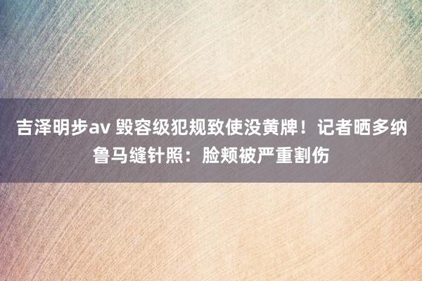 吉泽明步av 毁容级犯规致使没黄牌！记者晒多纳鲁马缝针照：脸颊被严重割伤